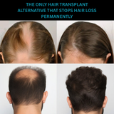 Hair Treatment Cream - Anti Dandruff + Hair Thickening